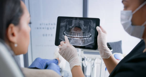 Licensed Tooth Extraction service in Santa Rosa, CA - Smile Center Dentistry